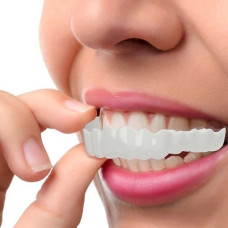 Знімні вініри для зубів Smile Veneers White, накладні зуби, накладки для зубів