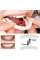 Знімні вініри для зубів Smile Veneers White, накладні зуби, накладки для зубів